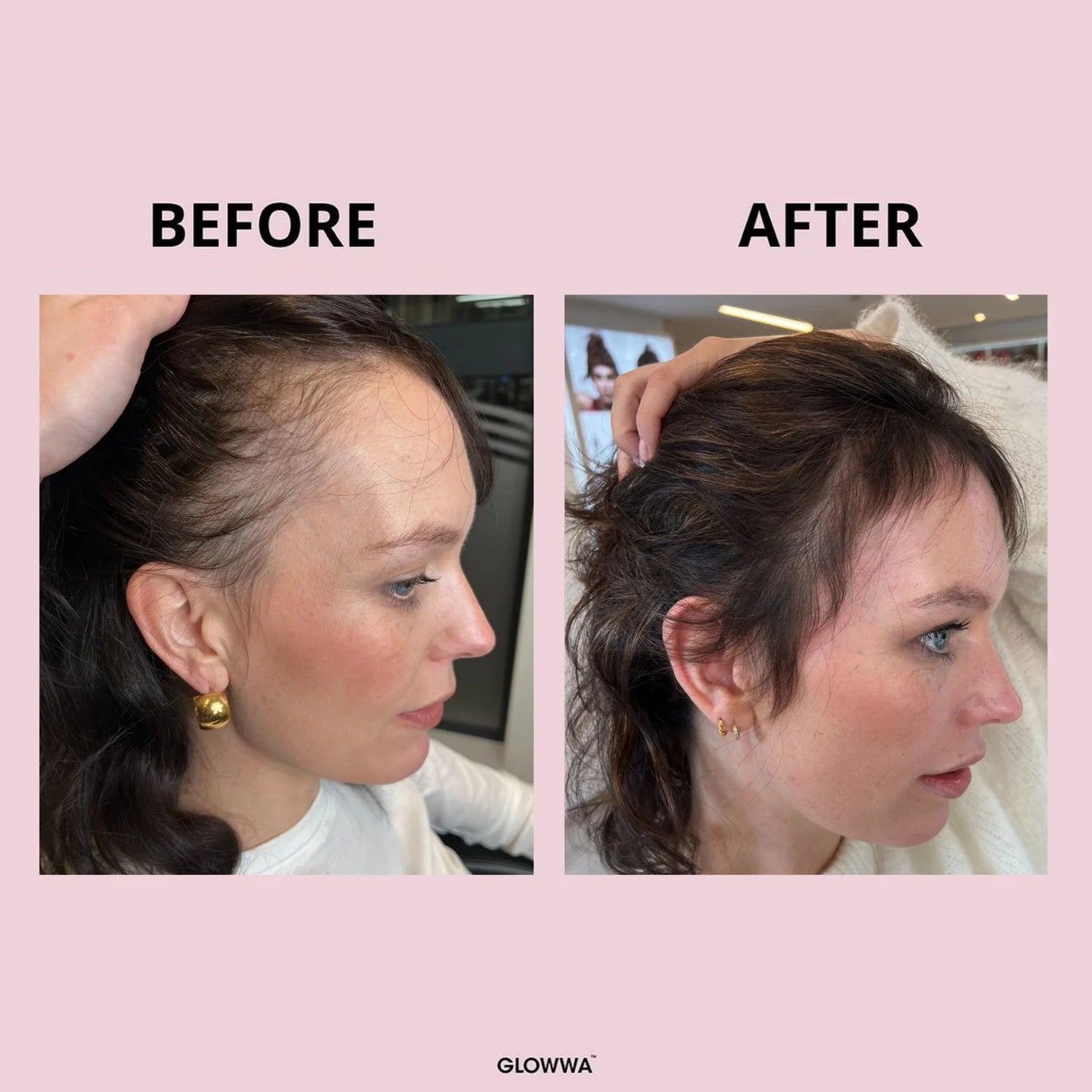 Glowwa Hair Food supplements